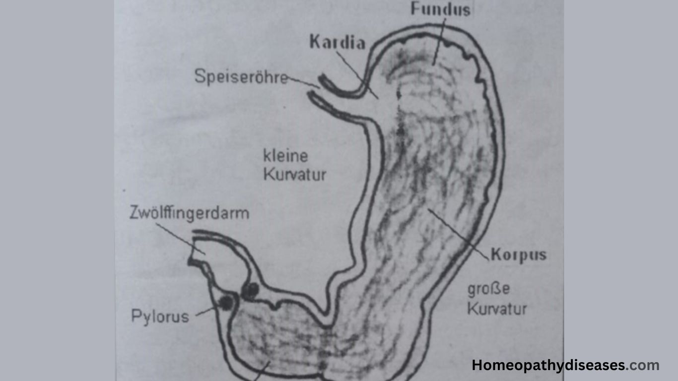 best-treatment-for-gastritis-inflammation-of-the-stomach-medical-term