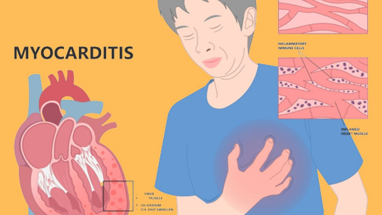 How_to_treat_Congestive_Cardiac_Failure_Sudden_heart_failure