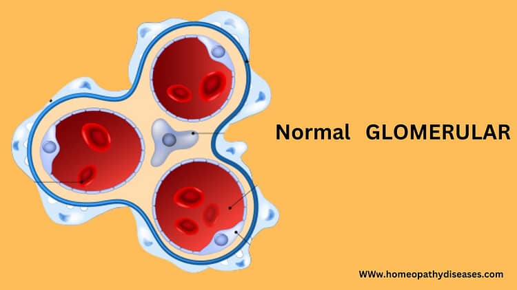 what-is-glomerular-infections-symptoms-and-treatment